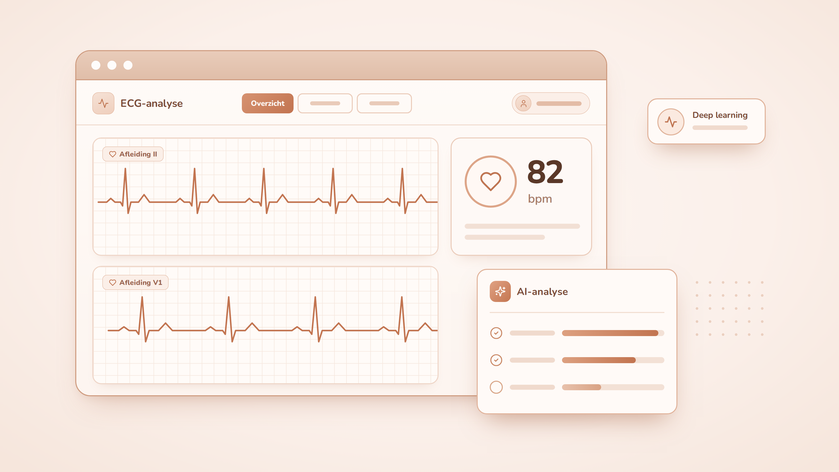 Projectafbeelding van MEDxAI ECG-analyse